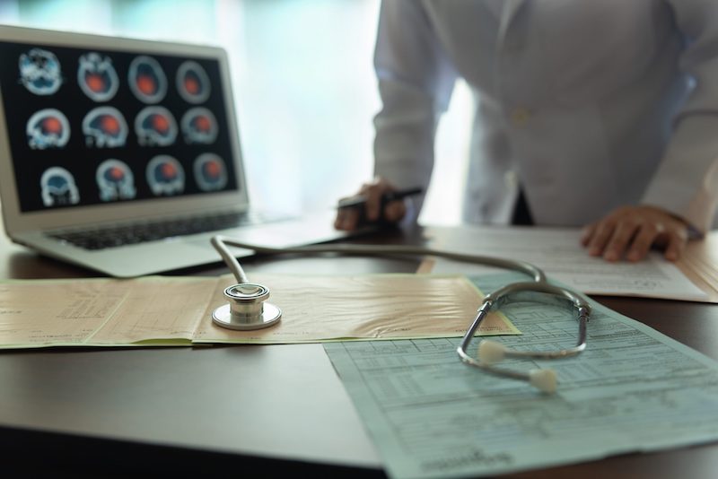 Can COVID-19 Cause a Stroke?