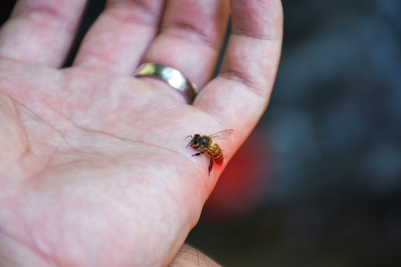 How to Treat Common Stings