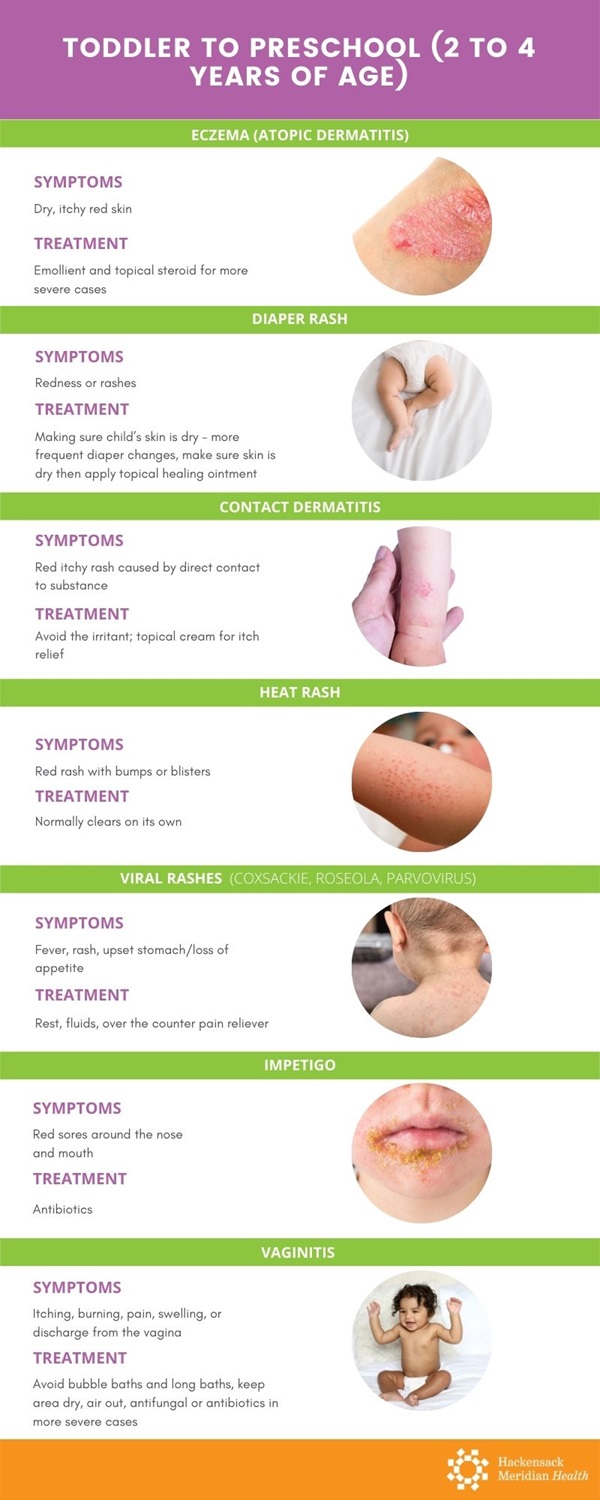 Common kid's rashes Infographic