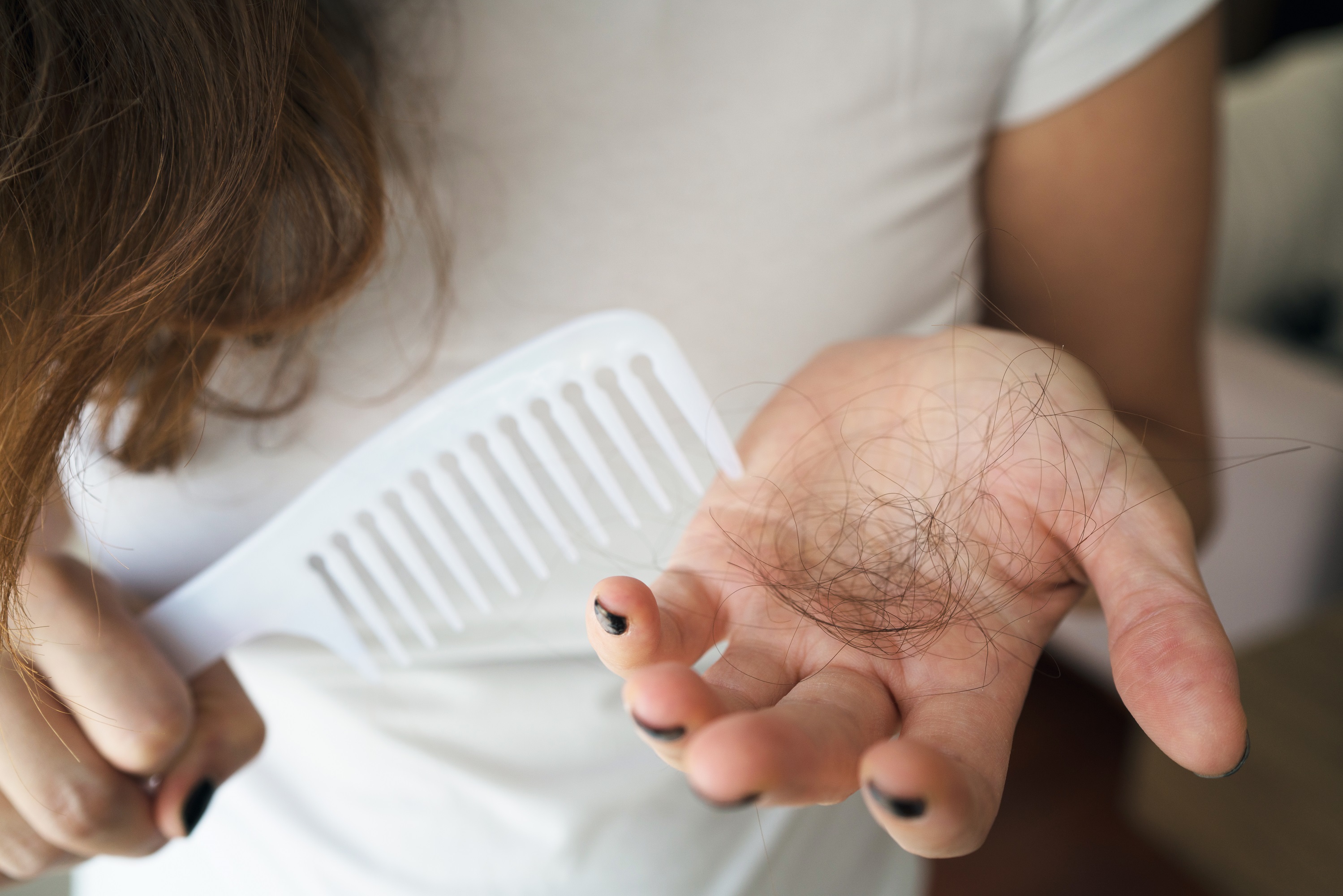 Hair loss image