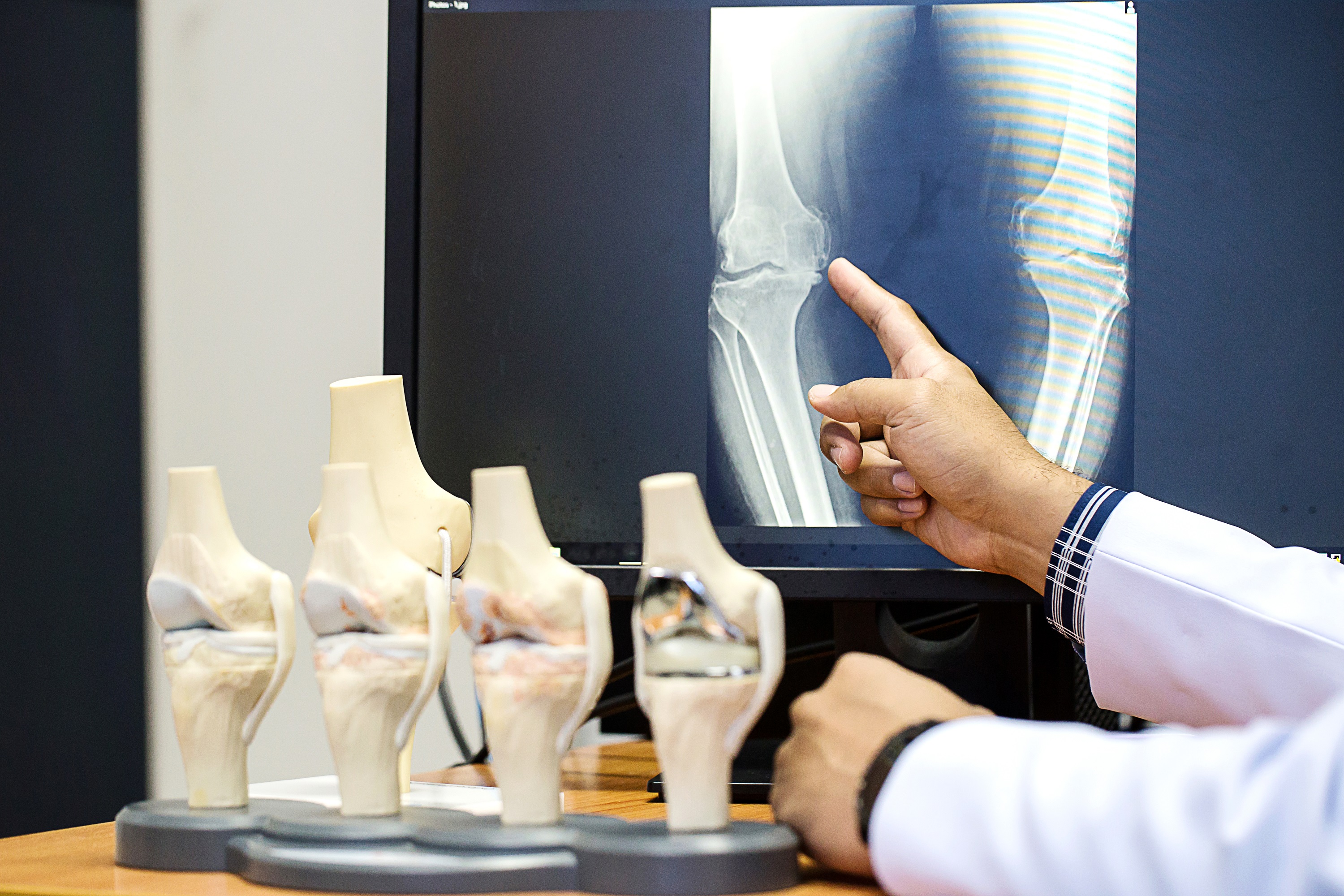 Knee models and x-ray