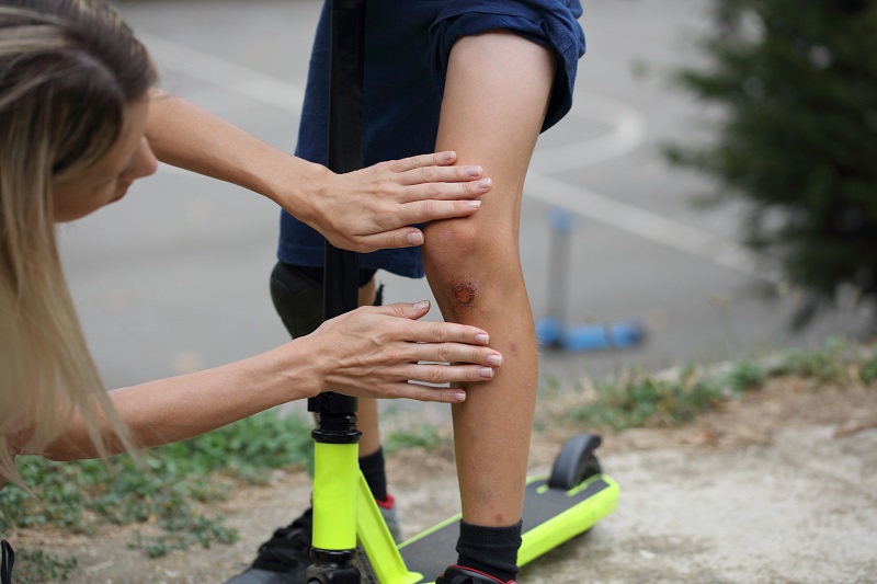 Boy injured his leg during scooter riding and mother treats her son skinned knee to prevent infection.