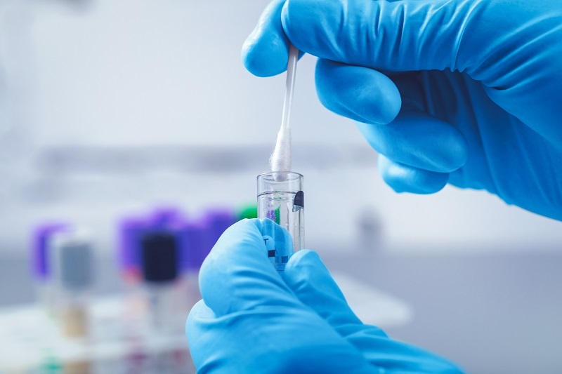 scientist in lab collect dna sample in test tube with cotton swab for genetic testing