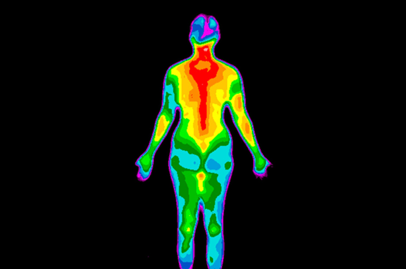 Thermographic photo of the back of the whole body of a woman with the photo showing different temperatures in a range of colors.