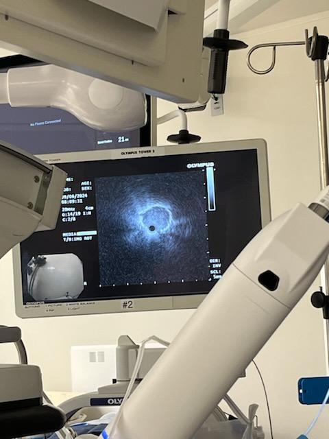 Interventional Pulmonary