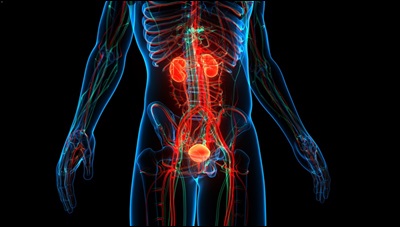 Bladder Cancer