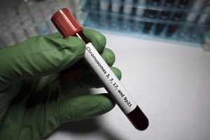 Bladder Cancer