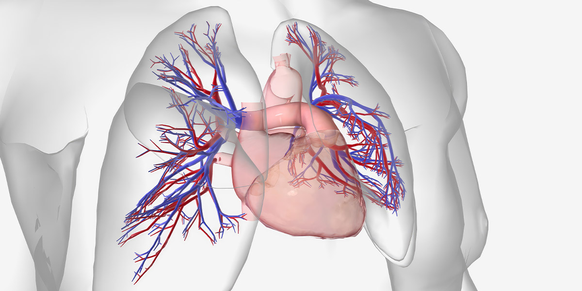 Pulmonary Hypertension