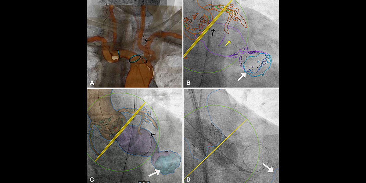 CT Fusion Imaging