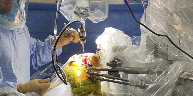 Robotic Surgery
